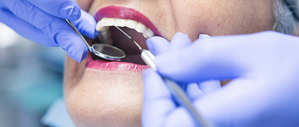Best Emergency Cosmetic Dentistry (e.g., broken veneers) in Blue Mound, IL
